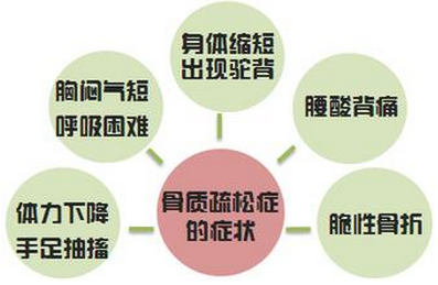 中德医生解析：骨质疏松症